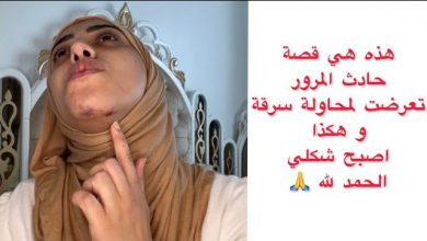 صورة هذه هي حقيقة حادث المرور لي صرالي و الحمد لله لي نجوت من الموت