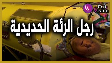 صورة شاهد..قصة أغرب إنسان في العالم يعيش داخل كبسولة حديدية منذ 1952